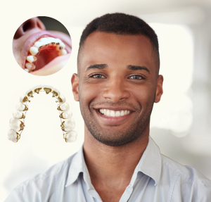 How To Manage Discomfort With Dental Braces